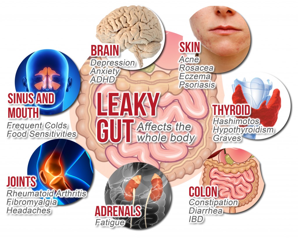 symptoms of an unhealthy gut